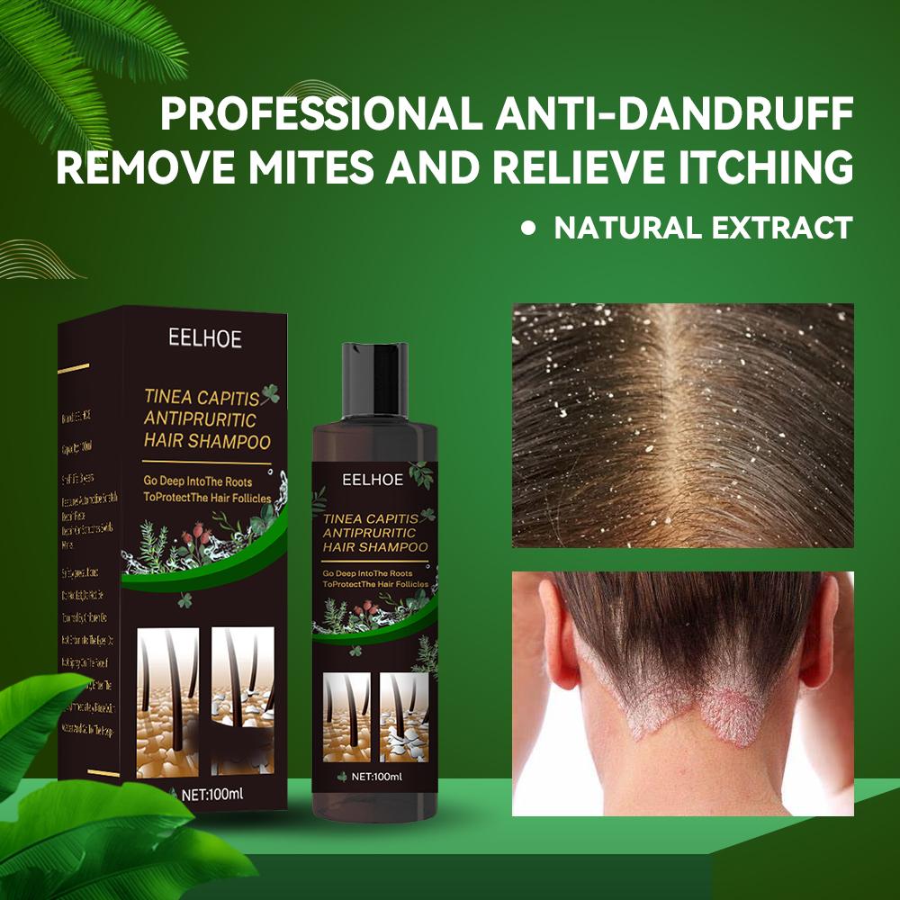 EELHOE Anti-Dandruff Shampoo - Itch Relief, Hair Loss Prevention, Oil Control &amp; Refreshing Care