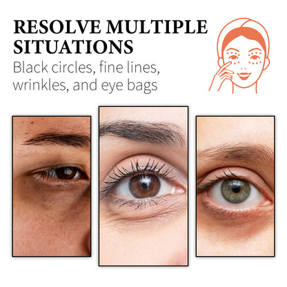 WIYUN Retinol &amp; Collagen Moisturizer Eye Cream, Lightening Dark Circles And Bags Under Eyes Moisturizing Firming Care Multi-Effect Eye Cream